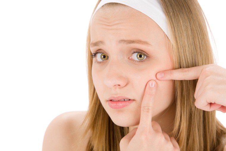 Acne facial care teenager woman squeezing pimple on white